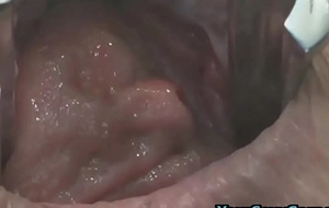 Extreme anal and pussy prolapse after aberrant dp